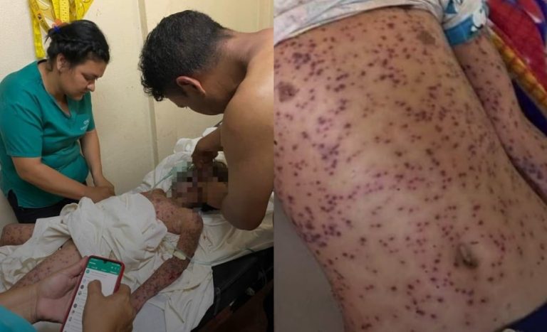 Bletët sulmojnë autobusin, 4 viktima