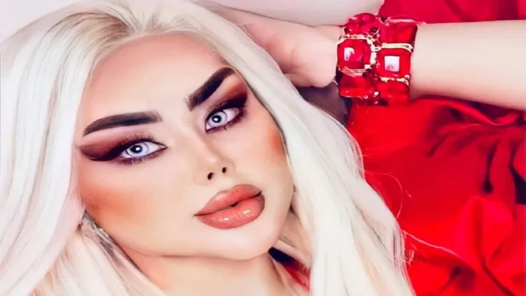 43 operacione për t’u dukur si Barbie, njerëzit e quajnë “zombi”! Fotot para ndërhyrjeve