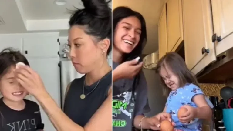 “Prindërit u thyejnë vezë në kokë fëmijëve për argëtim”, trendi në TikTok ngjall debat: Po i godisni fëmijët me salmonelë ballit