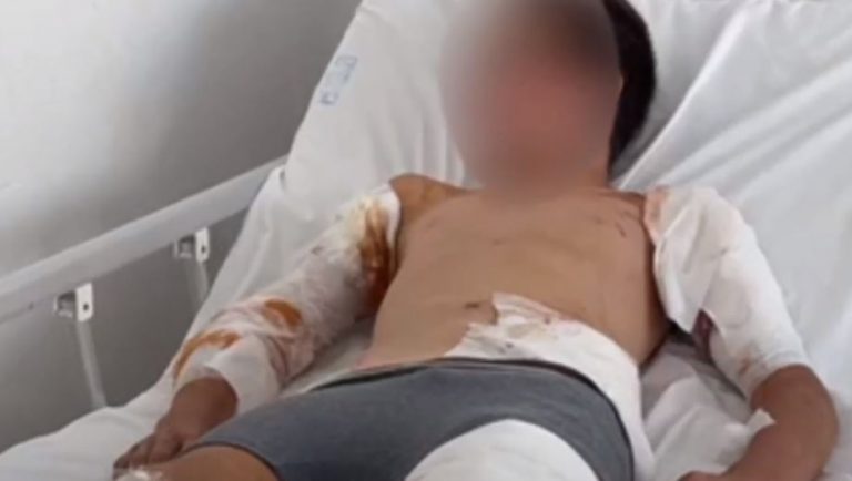 U sulmua nga qentë e stanit, 12 vjeçari jashtë rrezikut për jetën, banorët: Jemi të frikësuar për fëmijët, të merren masa