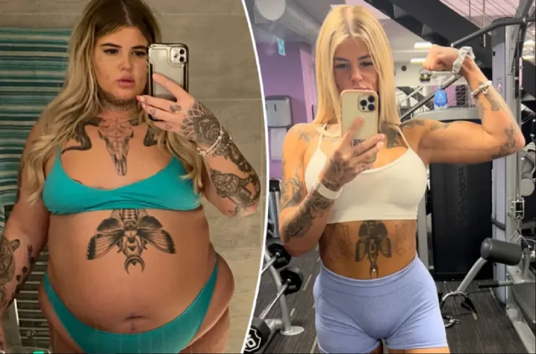 Shpenzoi 36 mijë euro për një trup perfekt, shihni ndryshimin drastik të kësaj vajze britanike