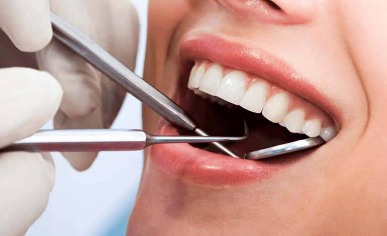 Nga Evropa në Elbasan për të rregulluar dhëmbët!