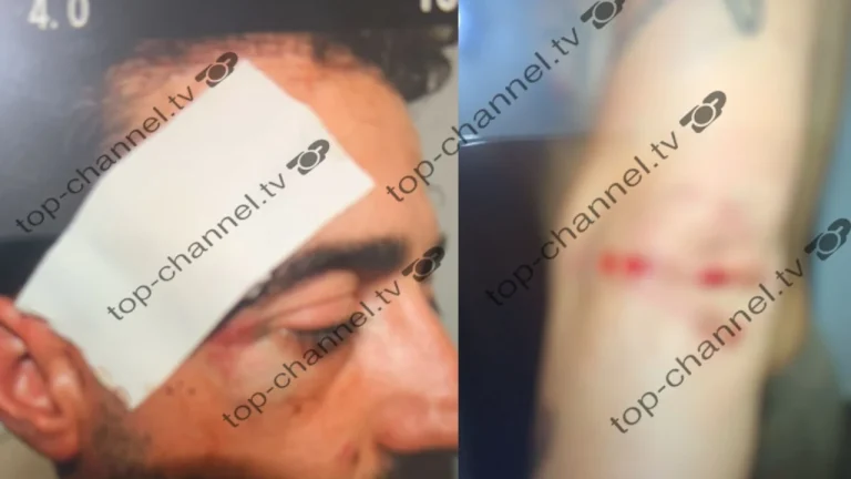 “Do t’ju vras të dyve!”, babai dhe xhaxhai dhunojnë barbarisht të dashurin e vajzës, 32-vjeçari ruhej me policë në spital