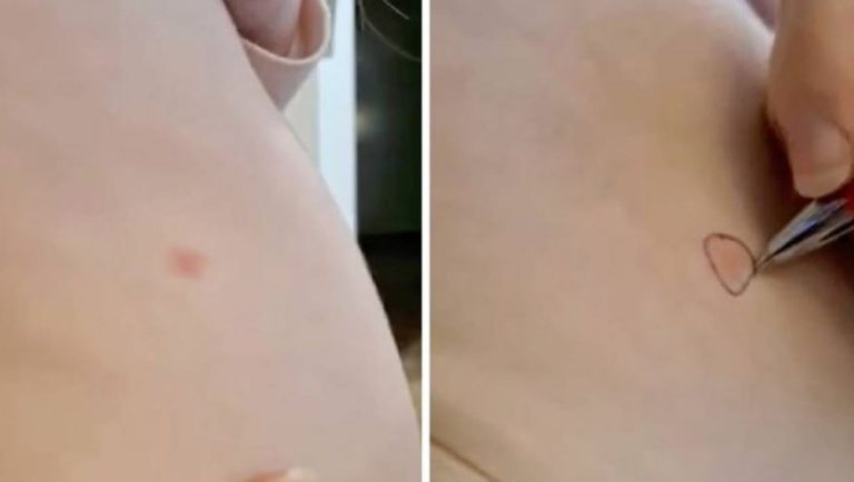 Ju duhet vetëm një stilolaps, ja truku që mund t’ju shpëtojë jetën