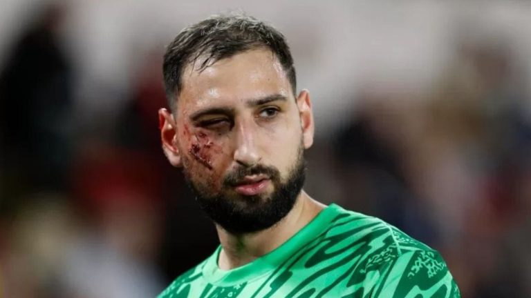 Masakrohet” Donnaroumma! Goditet me taka nga kundërshtari, 10 qepje në fytyrë