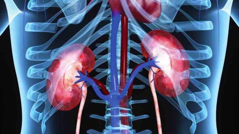 Përse Dhembin Veshkat pas Vakteve të Rënda – Kujdesi që ju duhet