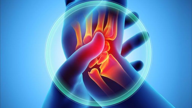 Pse ju dhëmbin kyçet kur bie shi? – Çfarë mund t’ju ndihmojë në qetësimin e tyre