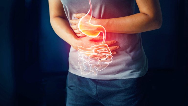 Vuani nga gastriti, këto janë ushqimet që nuk duhet të konsumoni