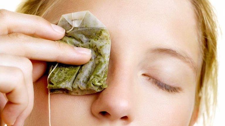 Bustinat e Çajit Bëjnë Mrekulli për Sytë – Cilat ju Duhen dhe si t’i Përdorni