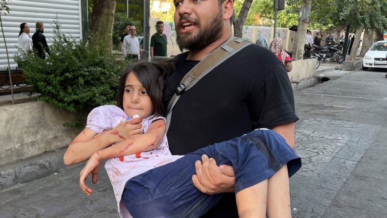 Kasaphanë në spitalet iraniane”, mjekët tregojnë jashtë kamerave tmerrin e vërtetë: Fëmijë të gjymtuar, nuk përballohet dot më