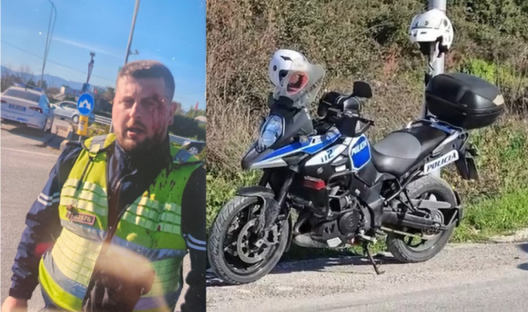 E rëndë në Vlorë, polici me familjen dhunojnë drejtorin e IMT-së dhe Policisë Bashkiake